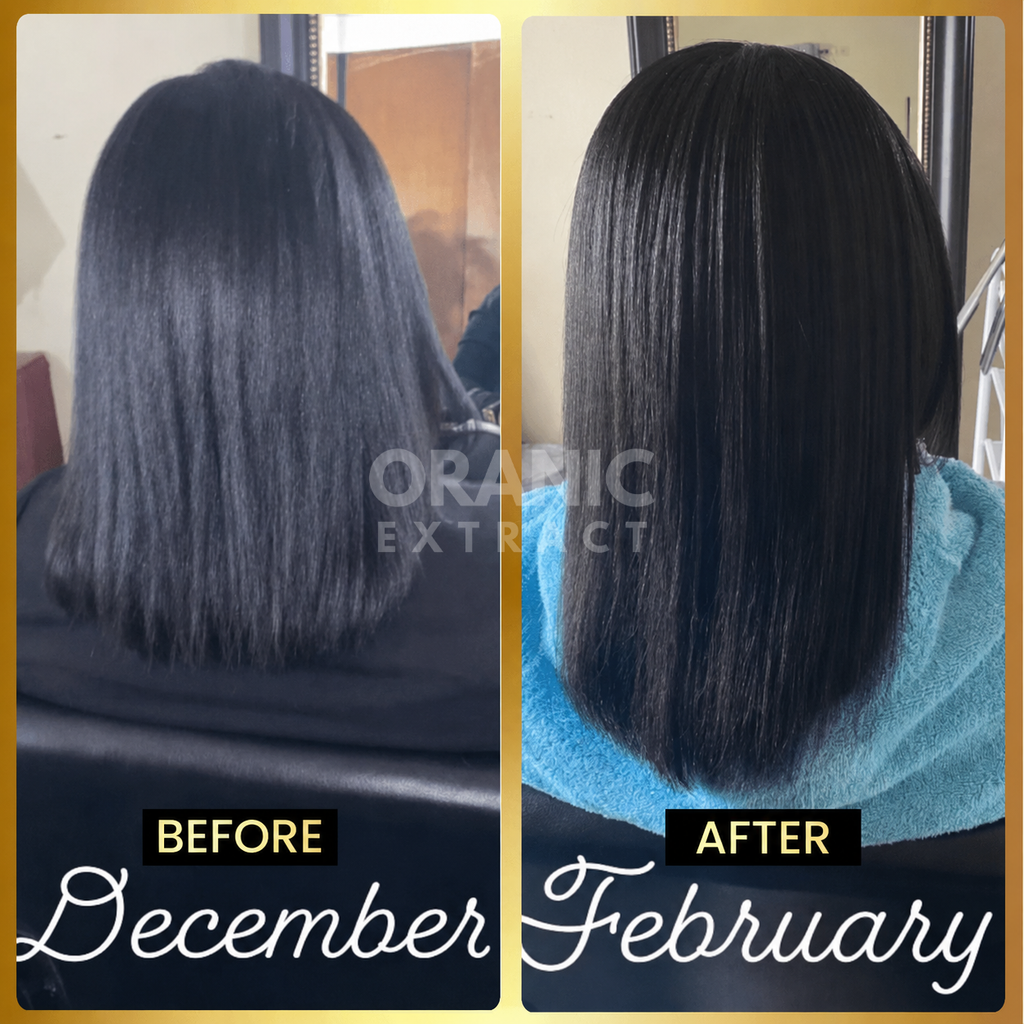 ORANIC EXTRACT® JUMBO Scalp Stimulator