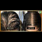 ORANIC EXTRACT® JUMBO Scalp Stimulator